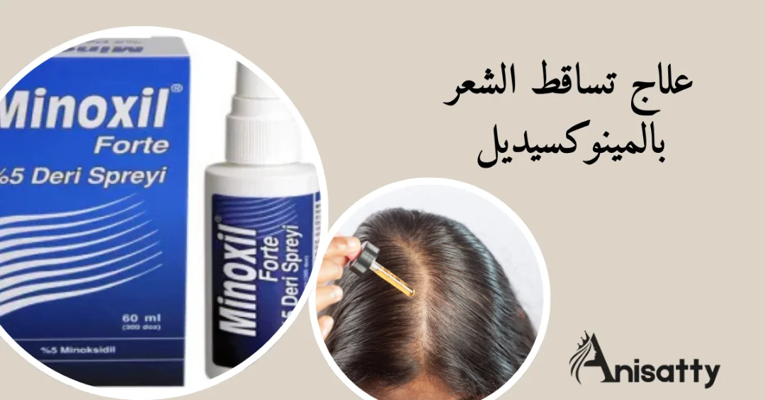 علاج تساقط الشعر بالمينوكسيديل-كل ما تحتاجين معرفته 1 مينوكسيديل 5% وسيدة تضع المينوكسيديل علي فروة الرأس ومكتوب علاج تساقط الشعر بالمينوكسيديل