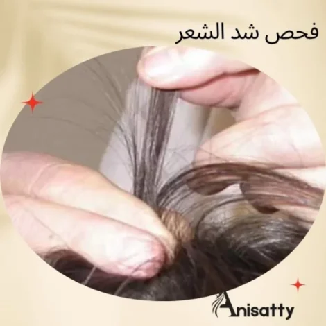 كل ما تحتاج معرفته عن فحوصات تساقط الشعر 2 فحص شد الشعر