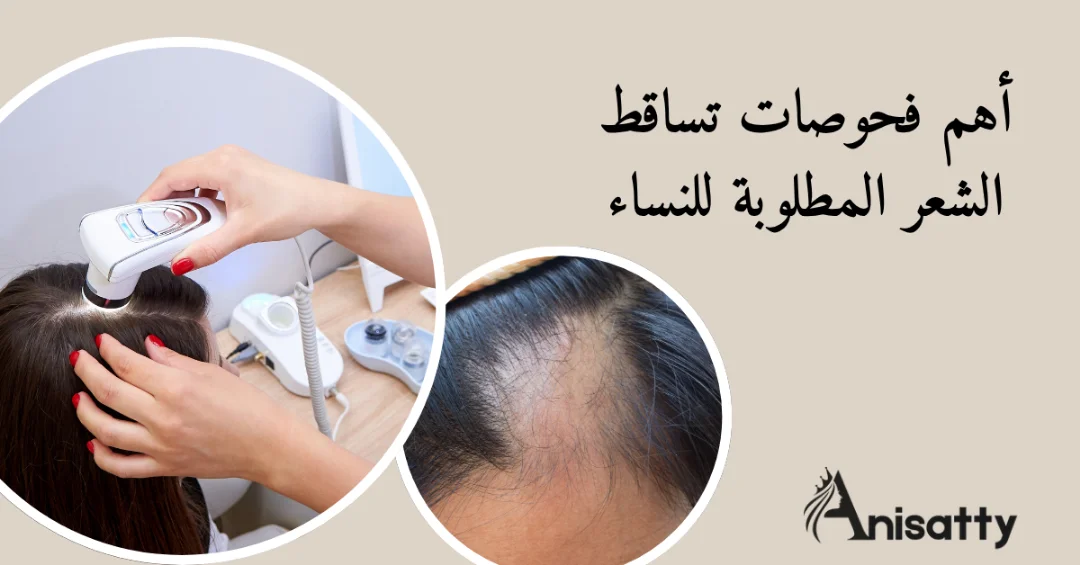 كل ما تحتاج معرفته عن فحوصات تساقط الشعر 1 منطقة خاليه من الشعر بفروة الرأس نتيجة تساقط الشعر فحص الترايكوسكوبي للشعر ومكتوب فحوصات تساقط الشعر